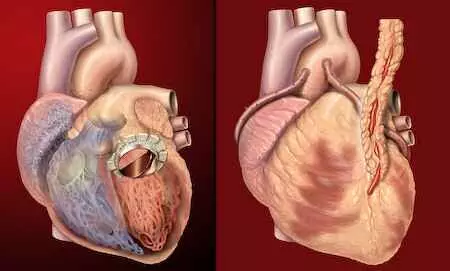 9 rare heart diseases